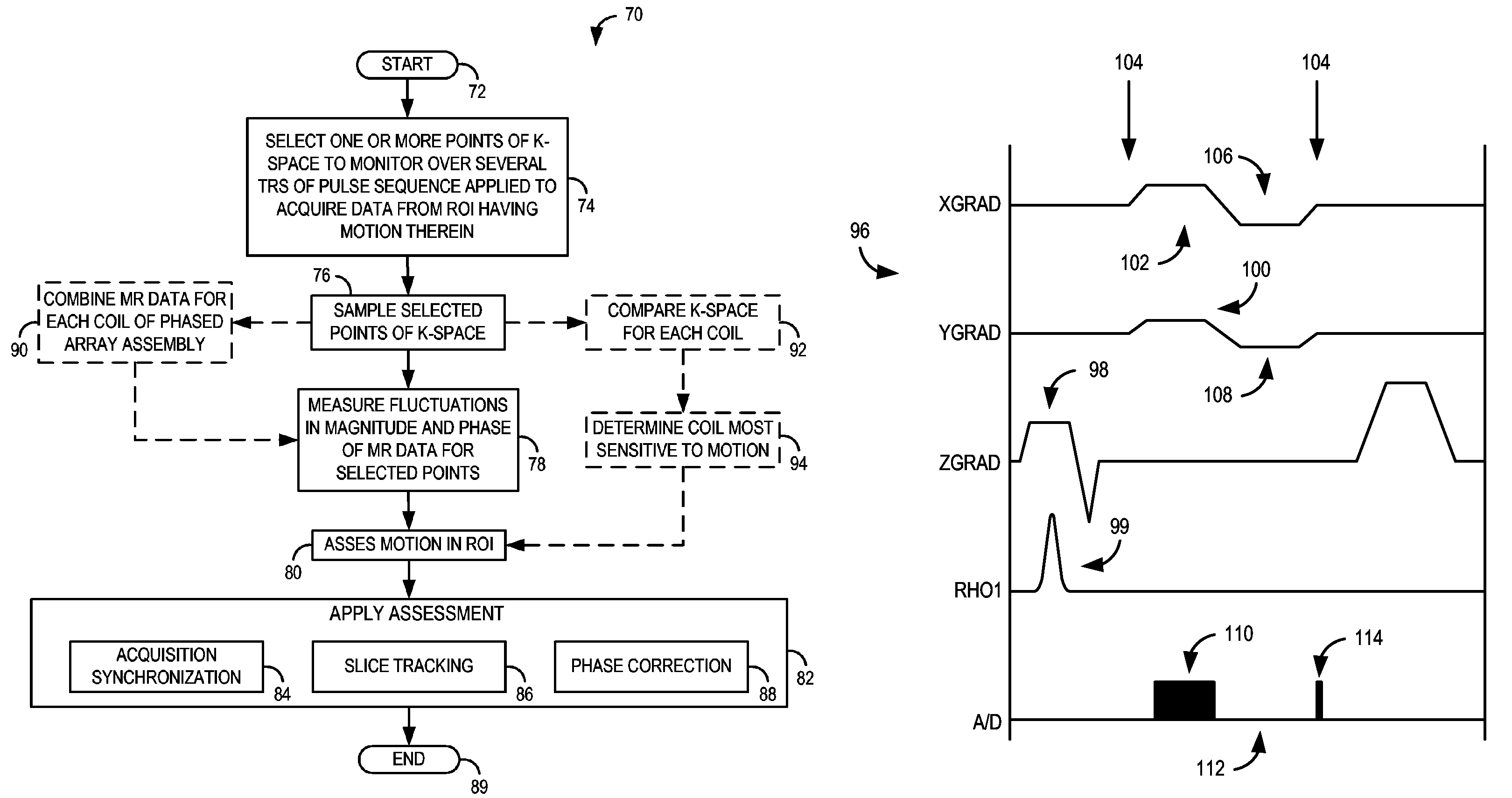 Method and system of determining motion in a region-of-interest directly and independently of k-space trajectory