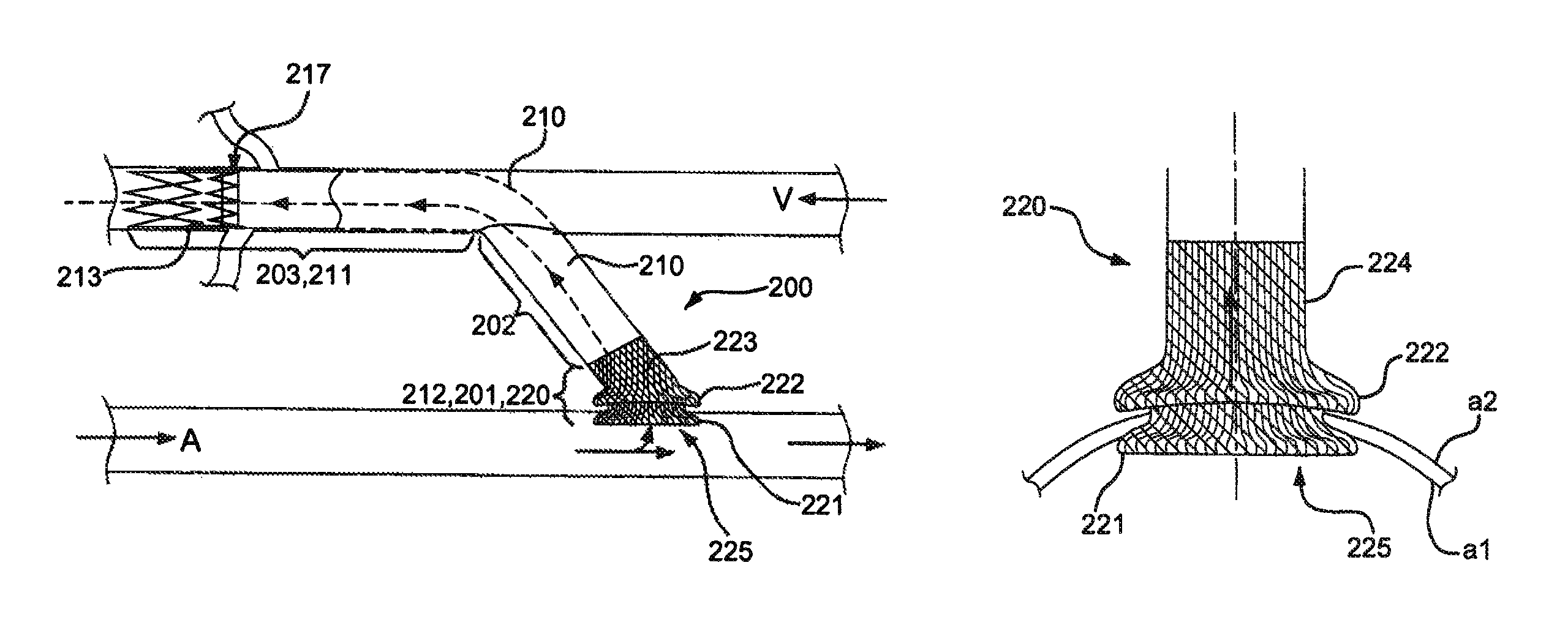 Anastomotic devices and methods