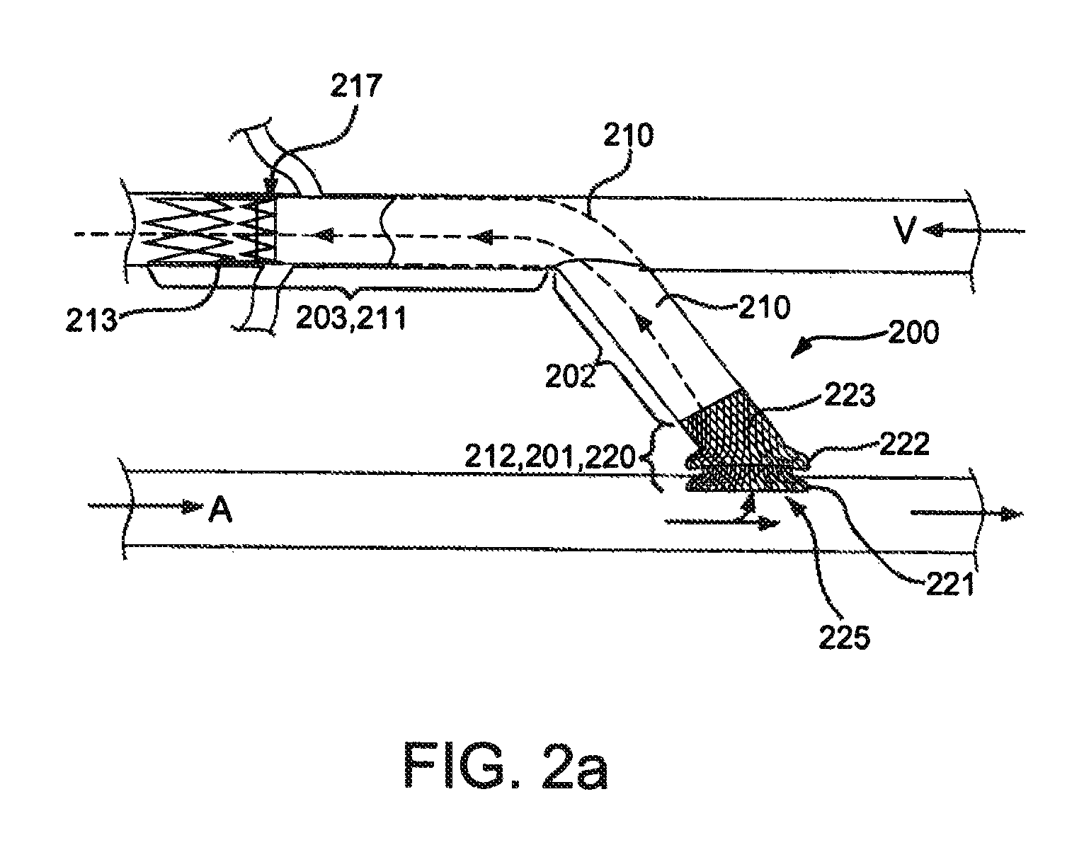 Anastomotic devices and methods