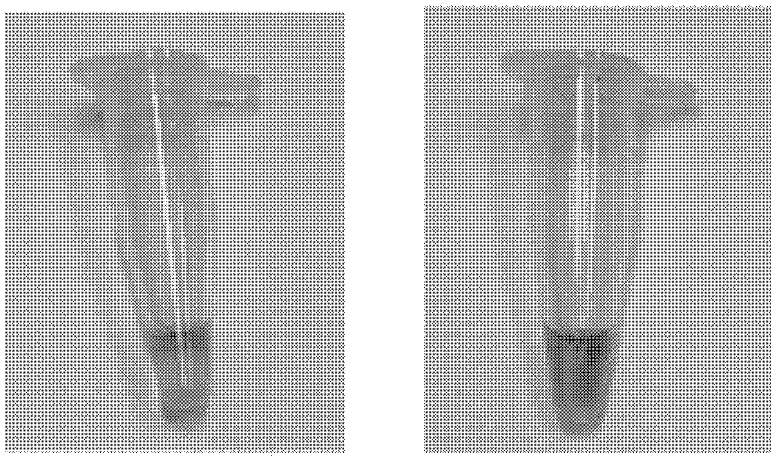 Loop-mediated isotherm amplification (LAMP) kit for detecting mycoplasma pneumoniae (Mp)