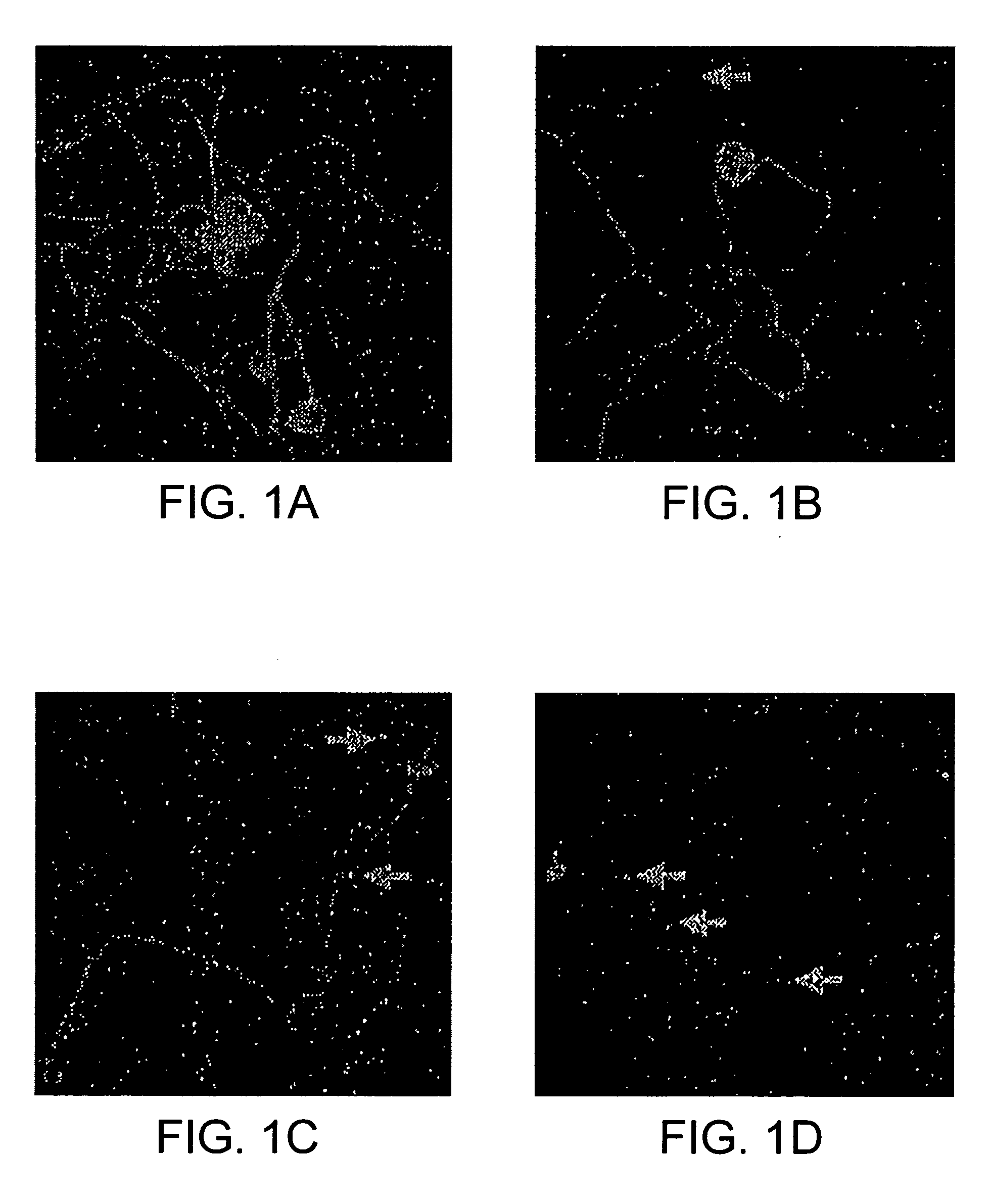 Immunophilin ligand treatment of antiretroviral toxic neuropathy