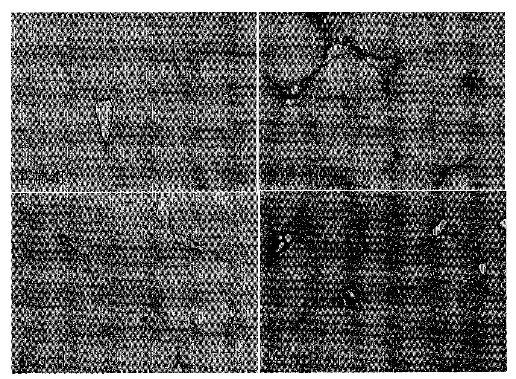 Chinese medicinal composition and application thereof