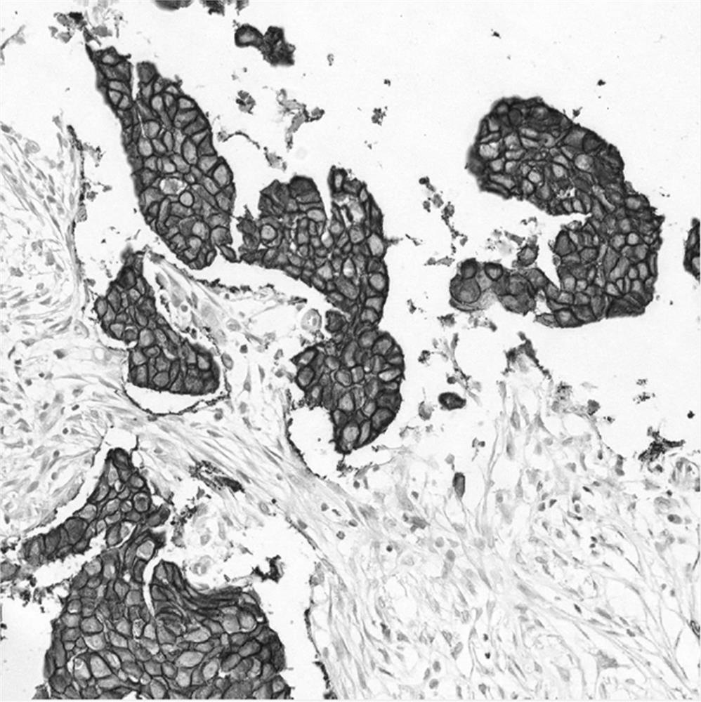 Method for judging cytomembrane coloring integrity of her2 pathological image based on transfer learning