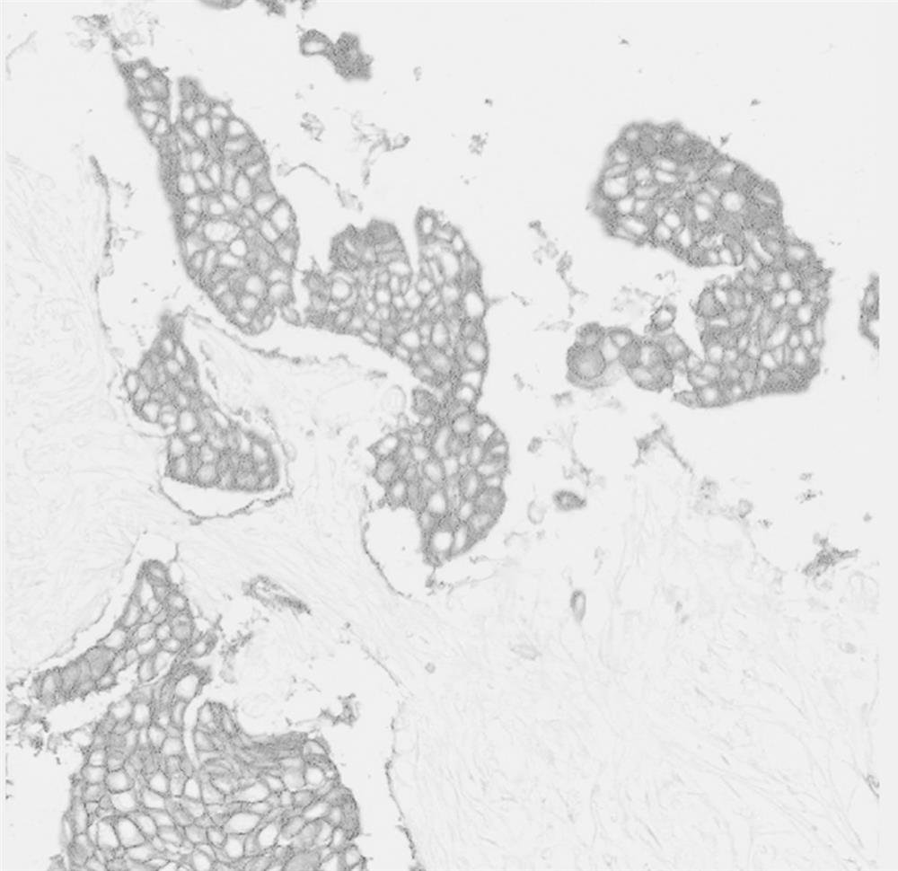 Method for judging cytomembrane coloring integrity of her2 pathological image based on transfer learning