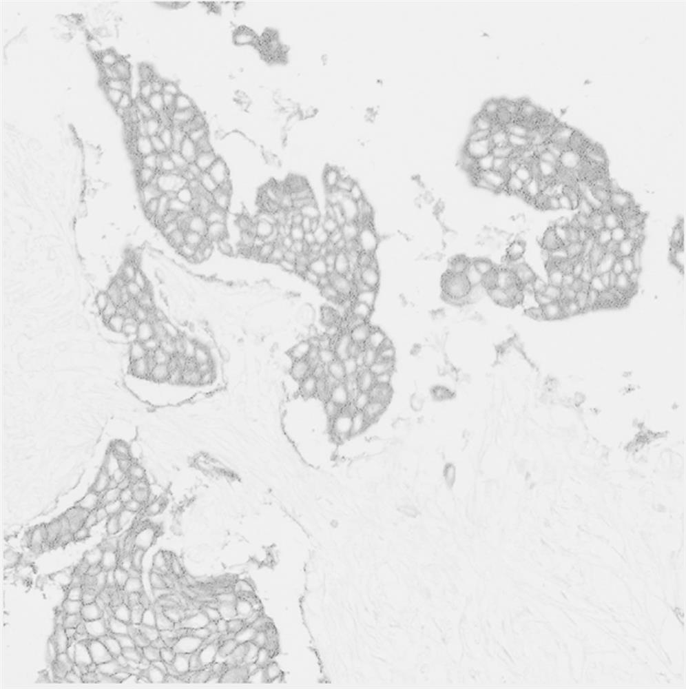 Method for judging cytomembrane coloring integrity of her2 pathological image based on transfer learning