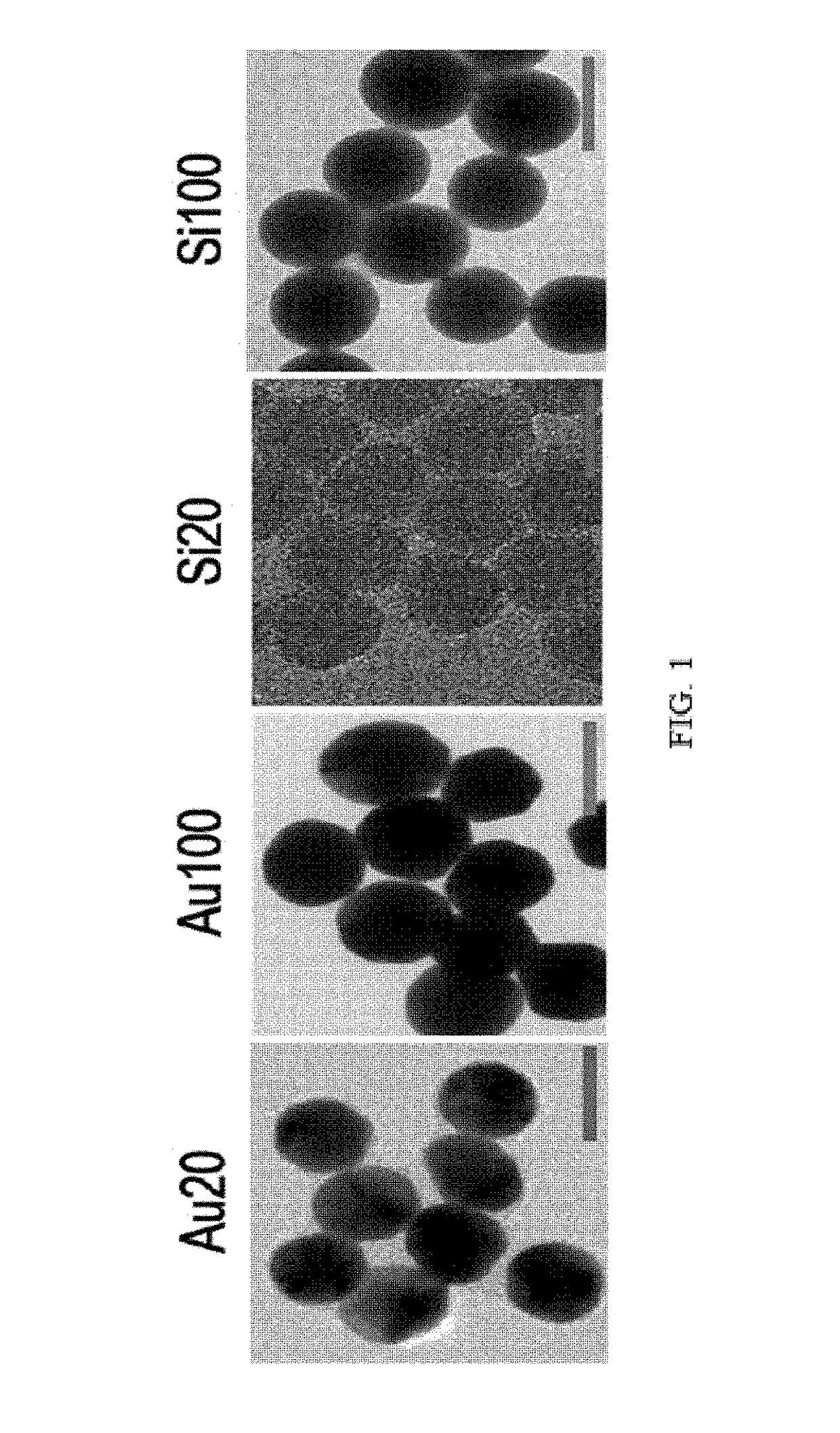 Composition for inhibiting angiogenesis comprising nanoparticle-vitreous body-based protein complex as active ingredient, and use thereof