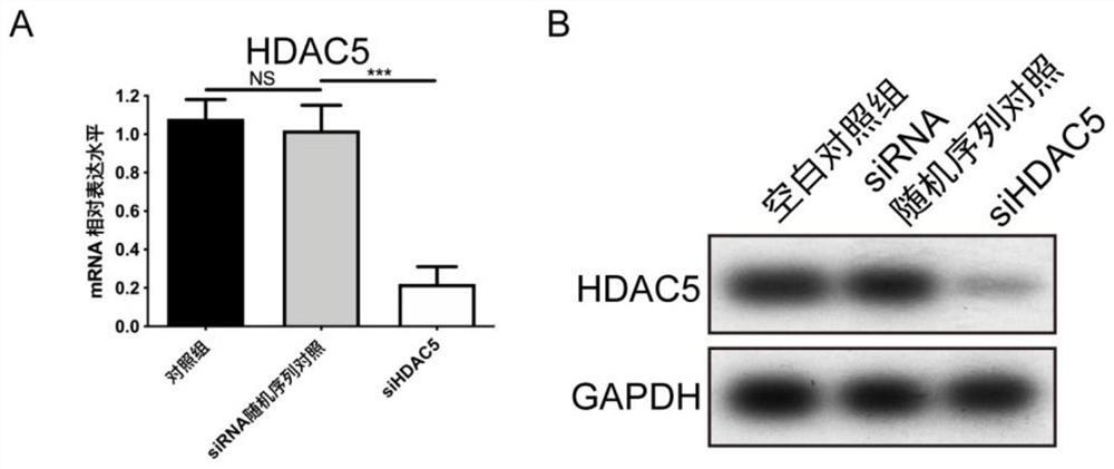 Use of the siRNA molecular composition in the preparation of medicines targeting hdac5 to inhibit scar formation