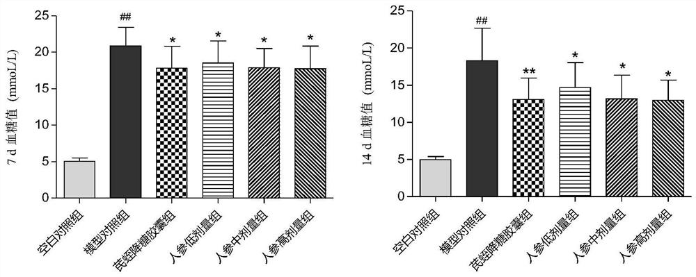 Application of ginseng GUBEN preparation in preparation of medicine for treating type II diabetes and preparation method thereof