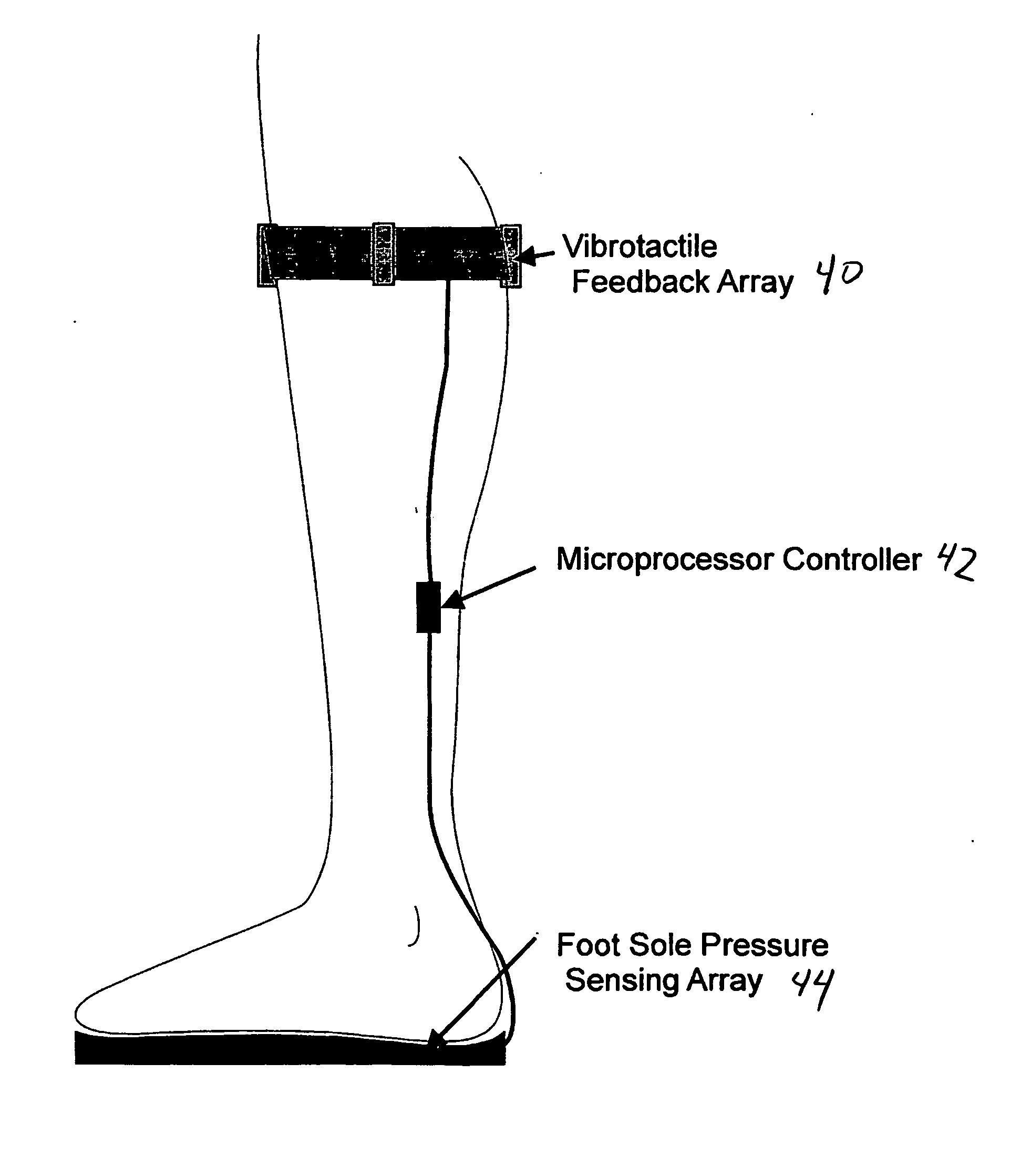 Sensor prosthetic for improved balance control