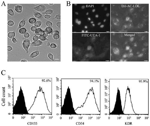 Composition for inhibiting calcification of endothelial progenitor cells and detection kit