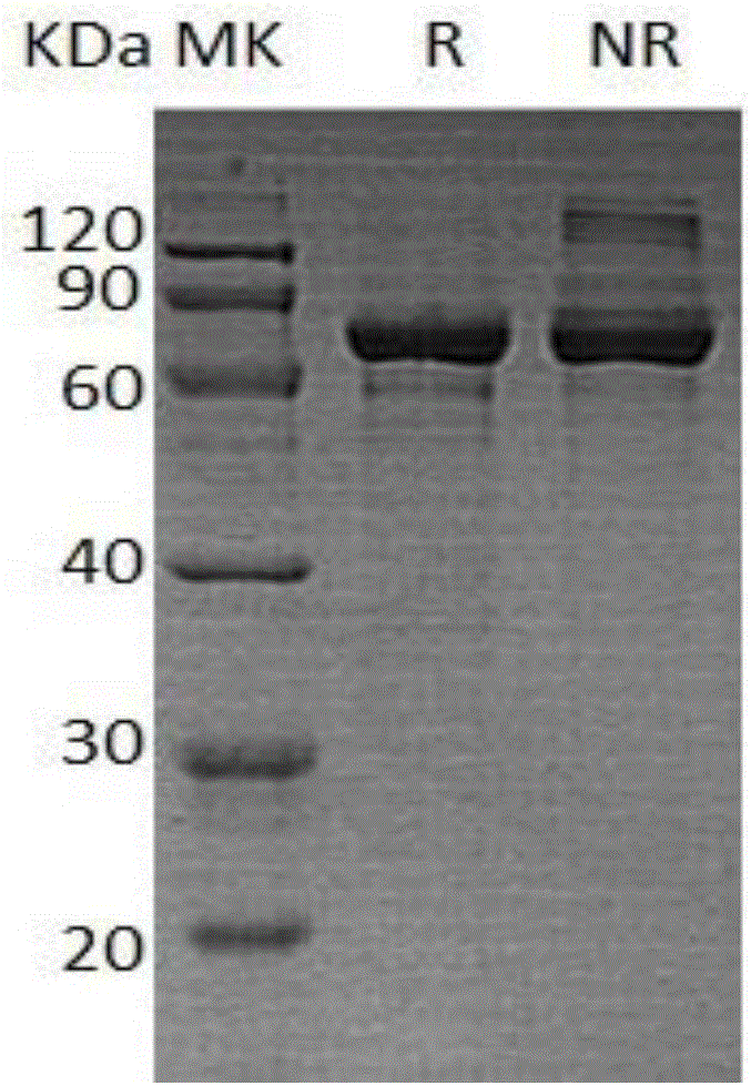 Preparation method and application of phi29 DNA polymerase