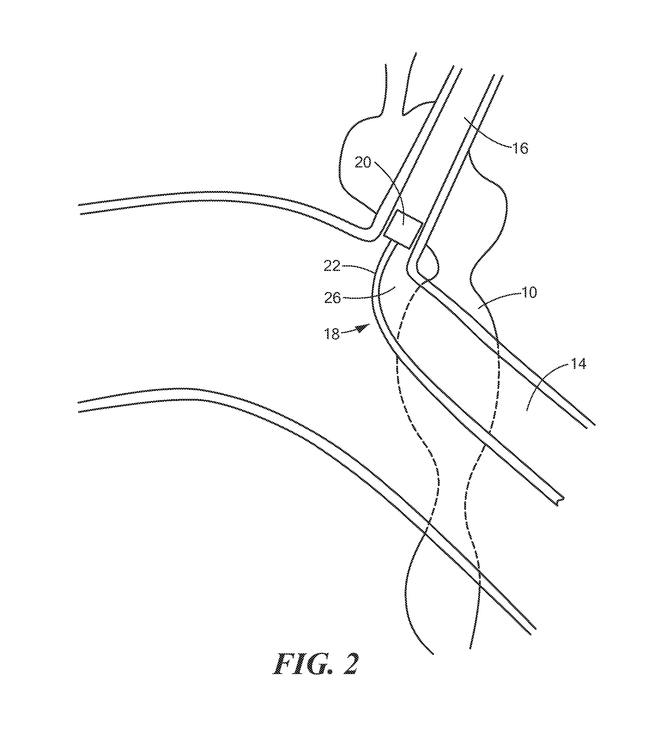 Spinal neuromodulation and associated systems and methods