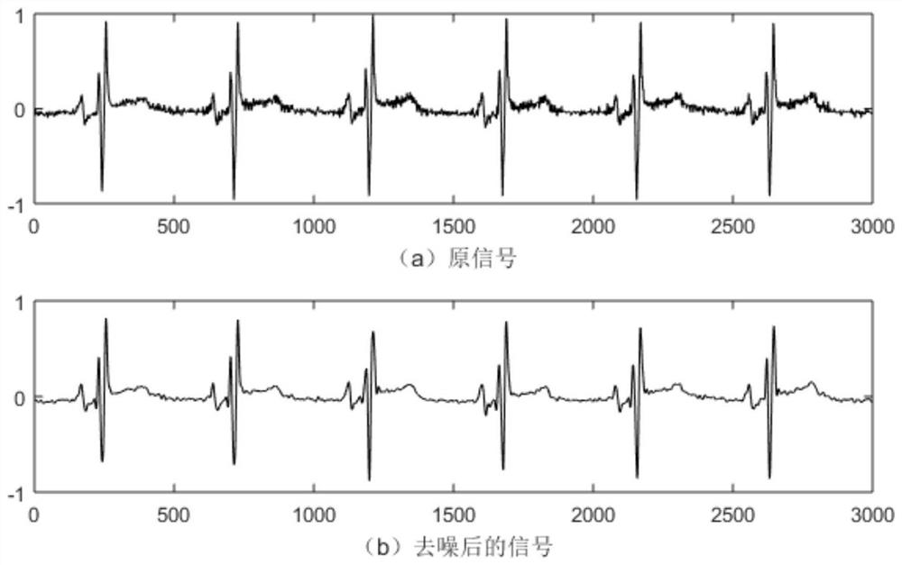 Electrocardiosignal identification method based on generative adversarial networks and convolution recurrent neural networks