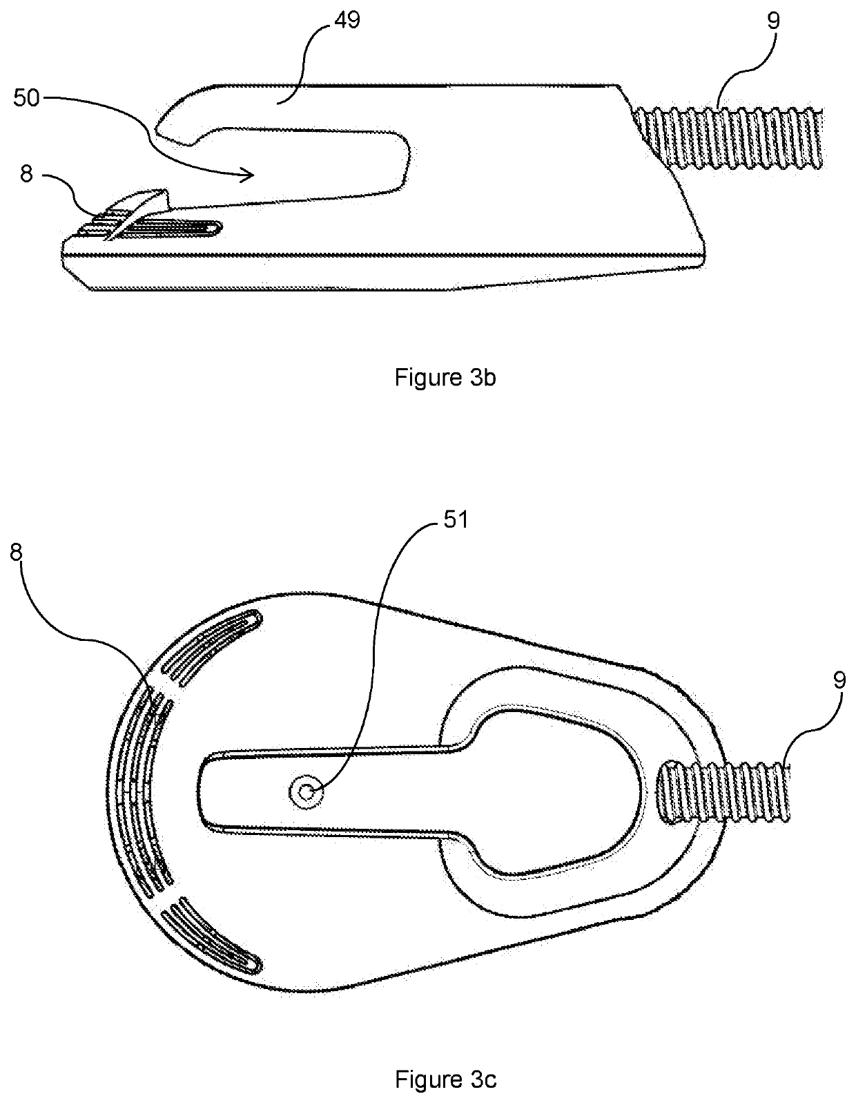 Aesthetic method of biological structure treatment by magnetic field