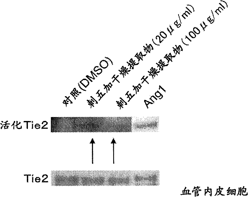 Stabilizer for lymph vessel