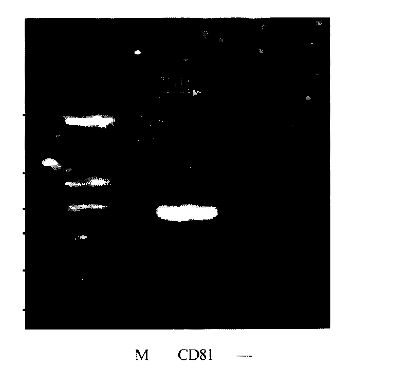 Taqman fluorescence probe quantitative PCR method adopting plasmid constructed by tree shrew CD81 gene as standard substance