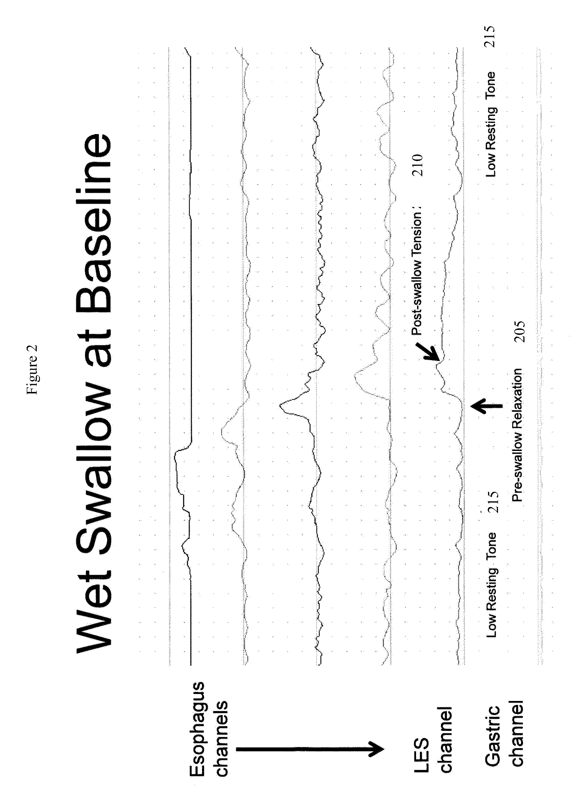 Device and implantation system for electrical stimulation of biological systems