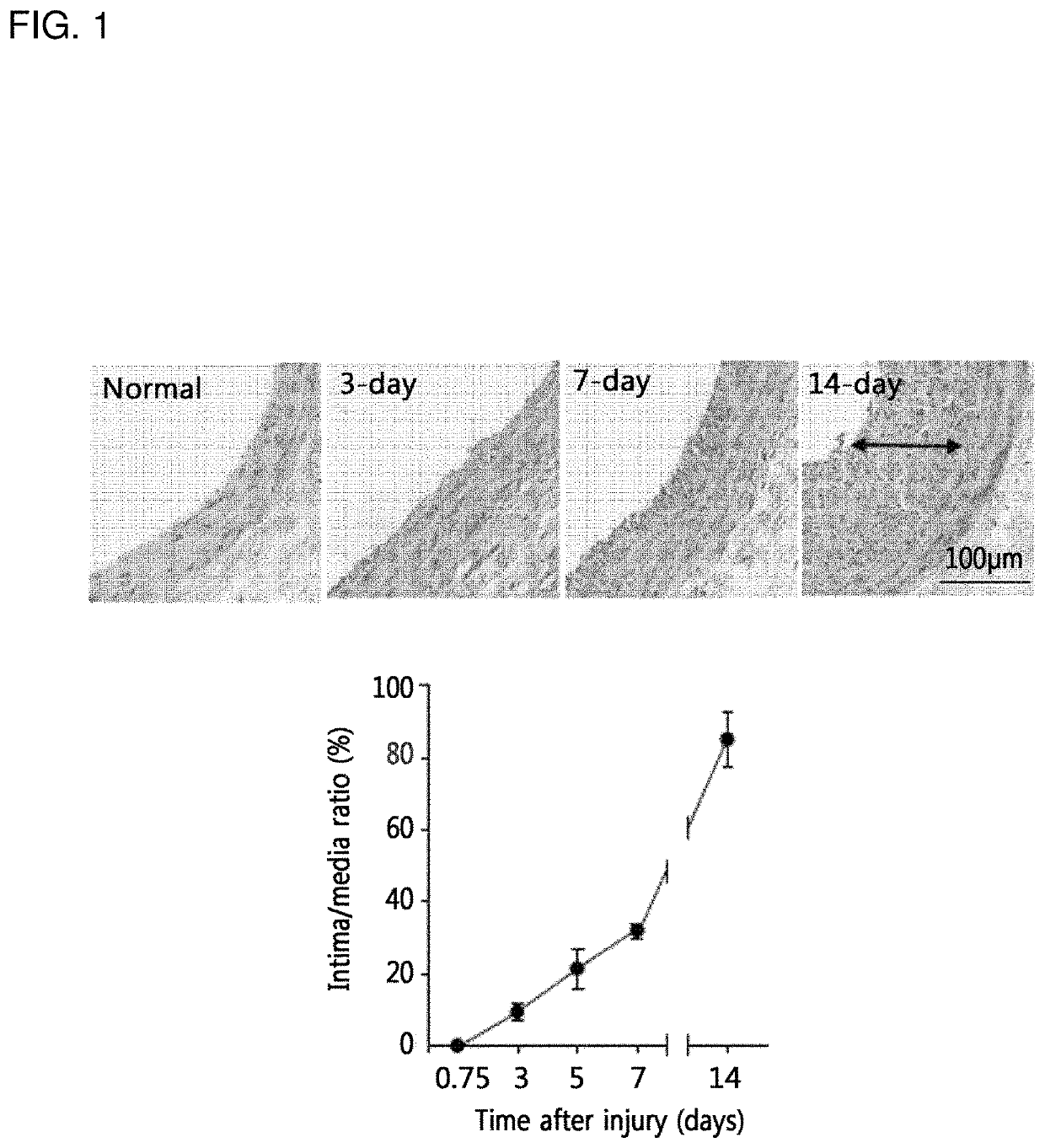 Biomarker for diagnosing vascular diseases and the uses thereof