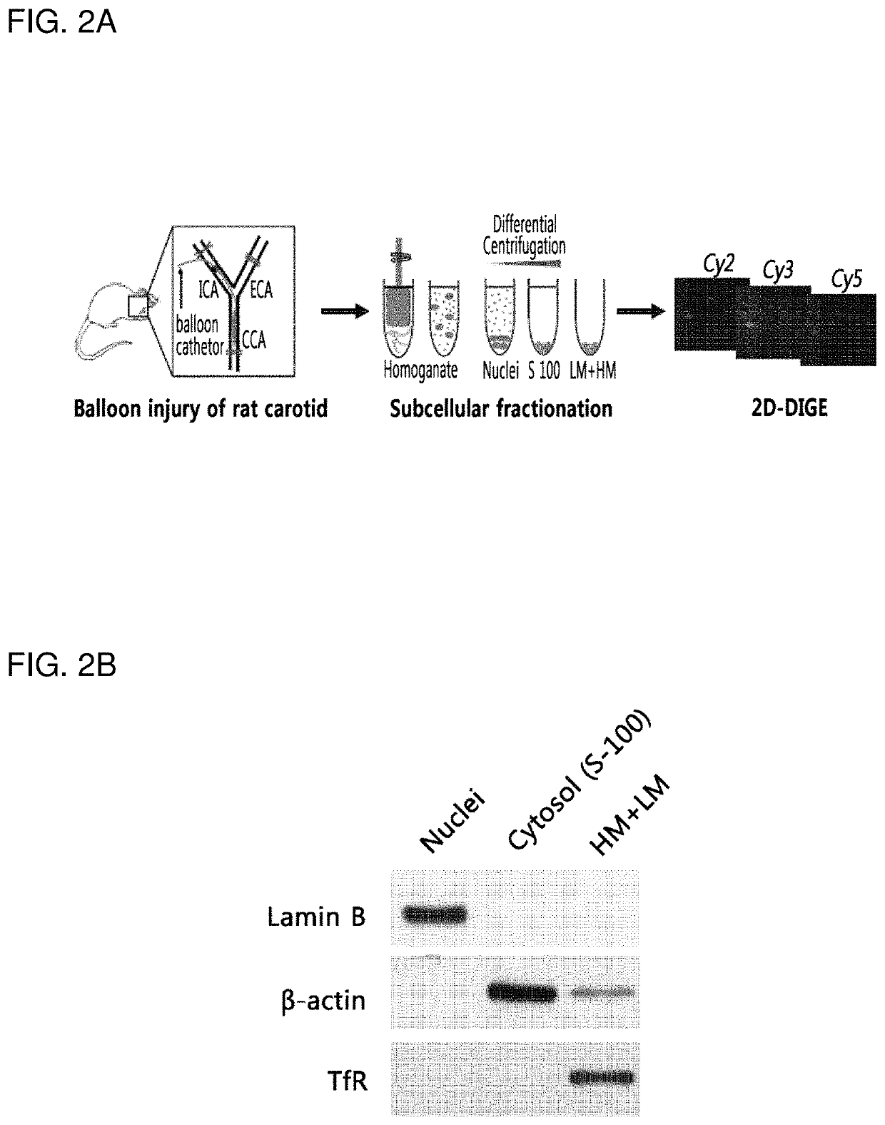 Biomarker for diagnosing vascular diseases and the uses thereof