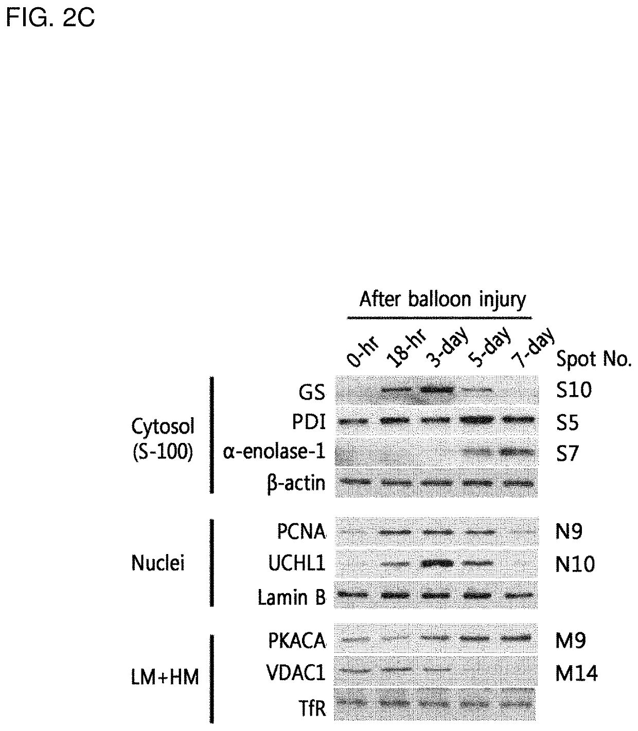 Biomarker for diagnosing vascular diseases and the uses thereof