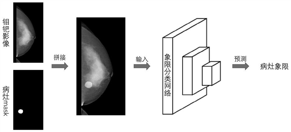 Breast image lesion matching method, device and storage medium