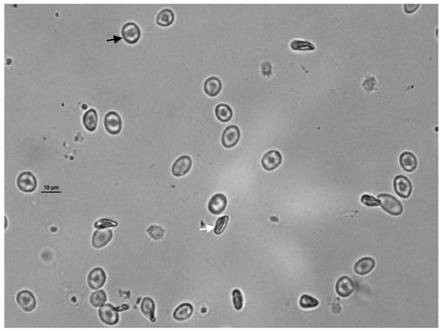 A method for isolating spermatogonial stem cells from turbot