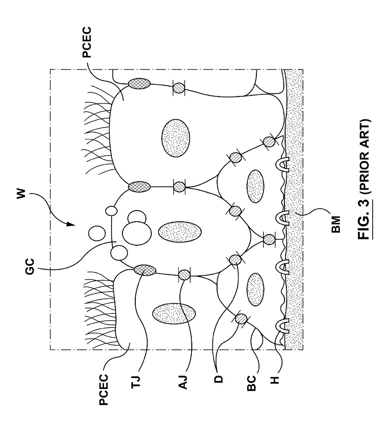 Methods, apparatuses, and systems for the treatment of pulmonary disorders