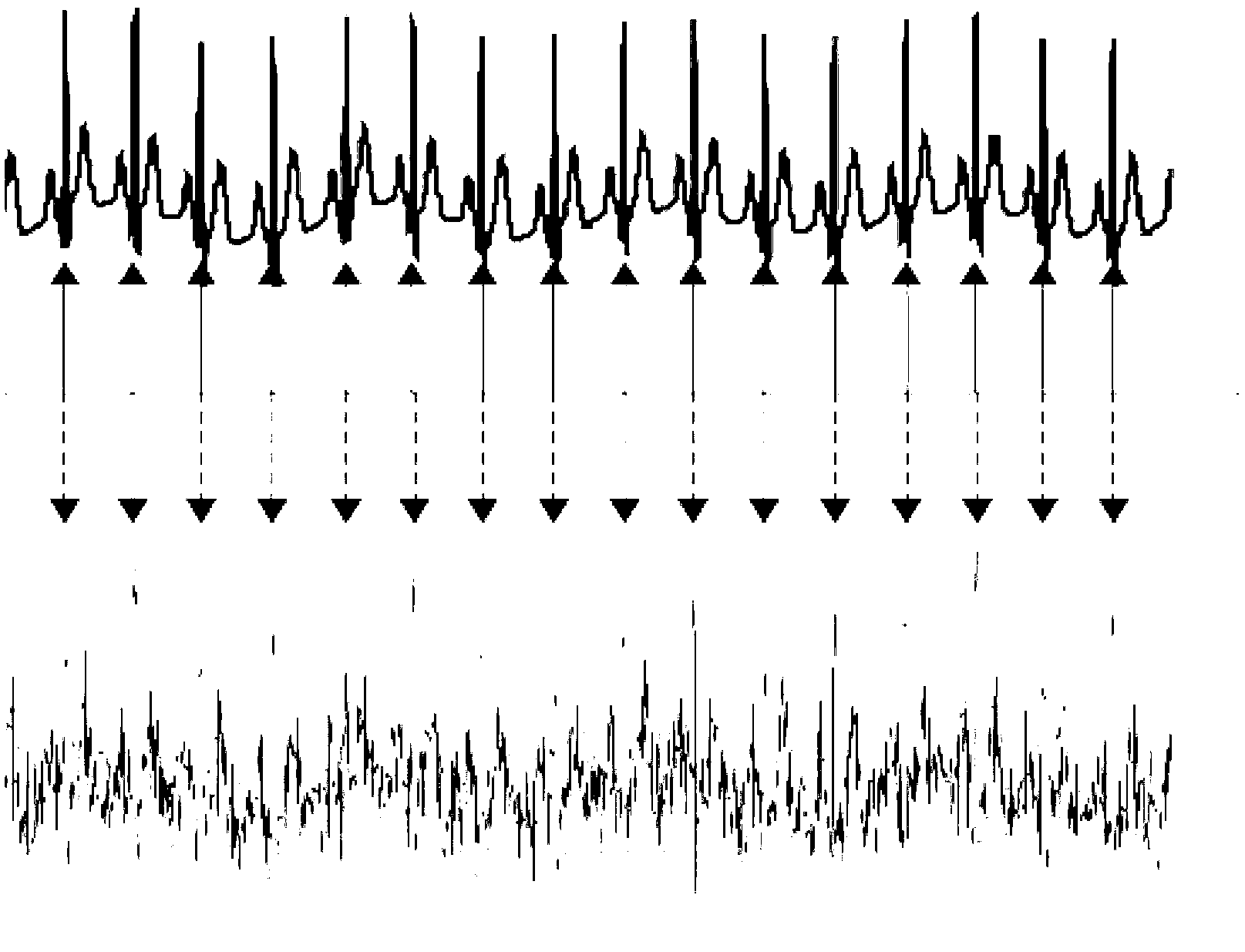 Self-adaption electrocardiograph (ECG) detection method and monitoring system thereof