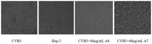 Polyiodinated aromatic acid modified Andersen polyacid organic derivatives and application thereof as CVB3 virus inhibitor