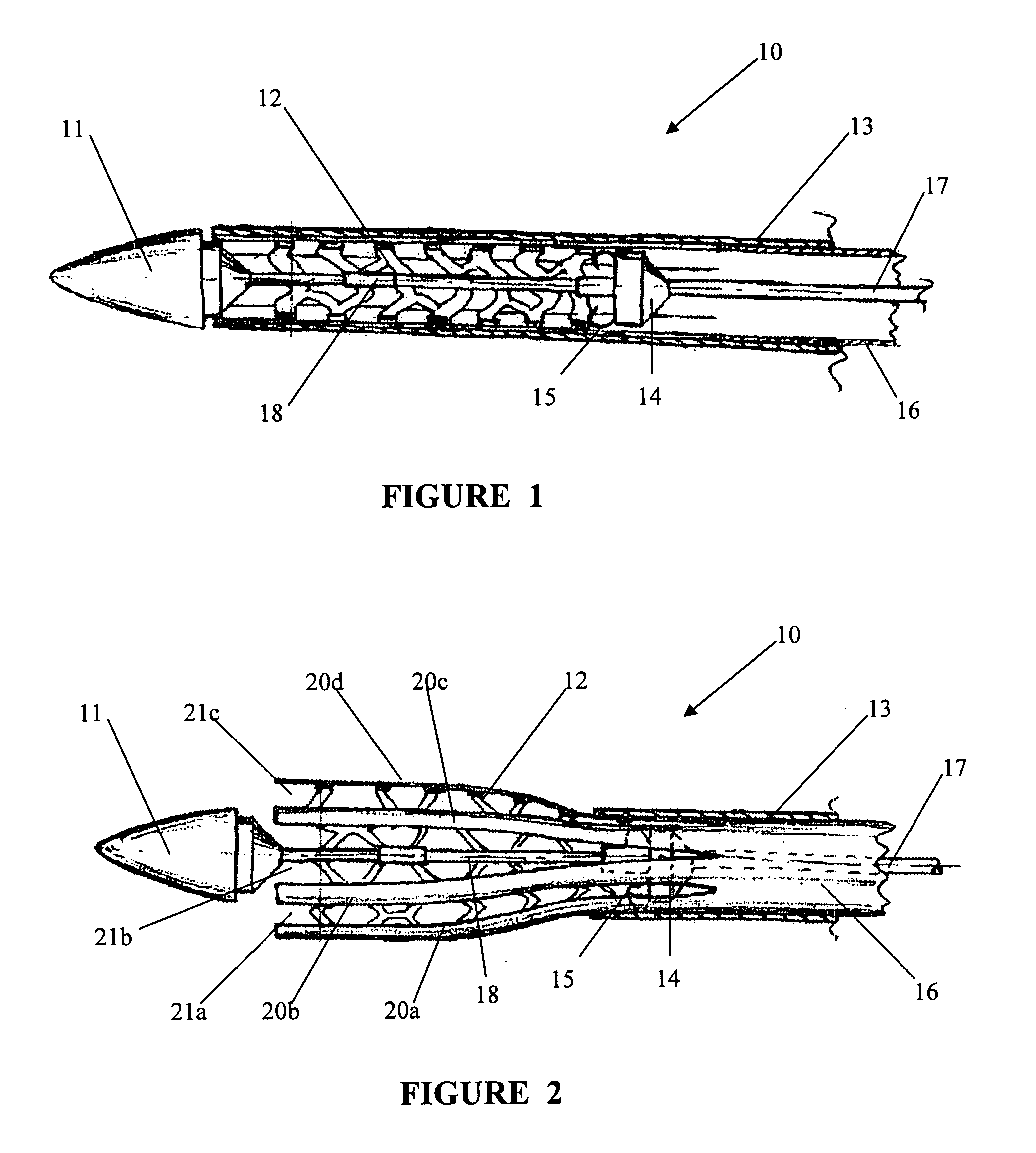 Delivery system for self-expanding stent, a method of using the delivery system, and a method of producing the delivery system