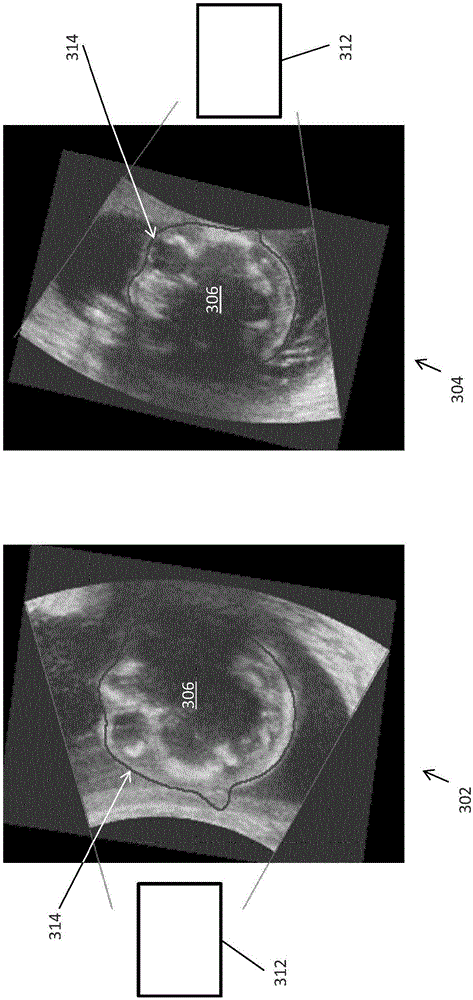 Acquisition-orientation-dependent features for model-based segmentation of ultrasound images