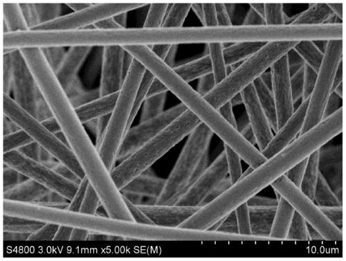 A kind of preparation method of skin-adhesive nano silver ion antibacterial dressing