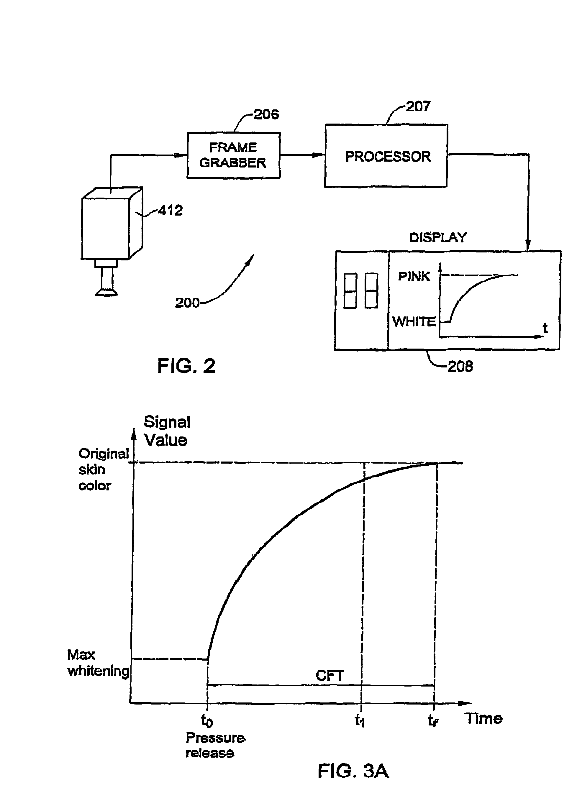 Non-invasive method and apparatus to detect and monitor early medical shock, and related conditions