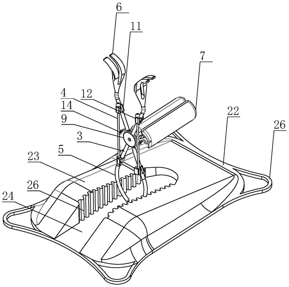 Support device for umbilical cord prolapse