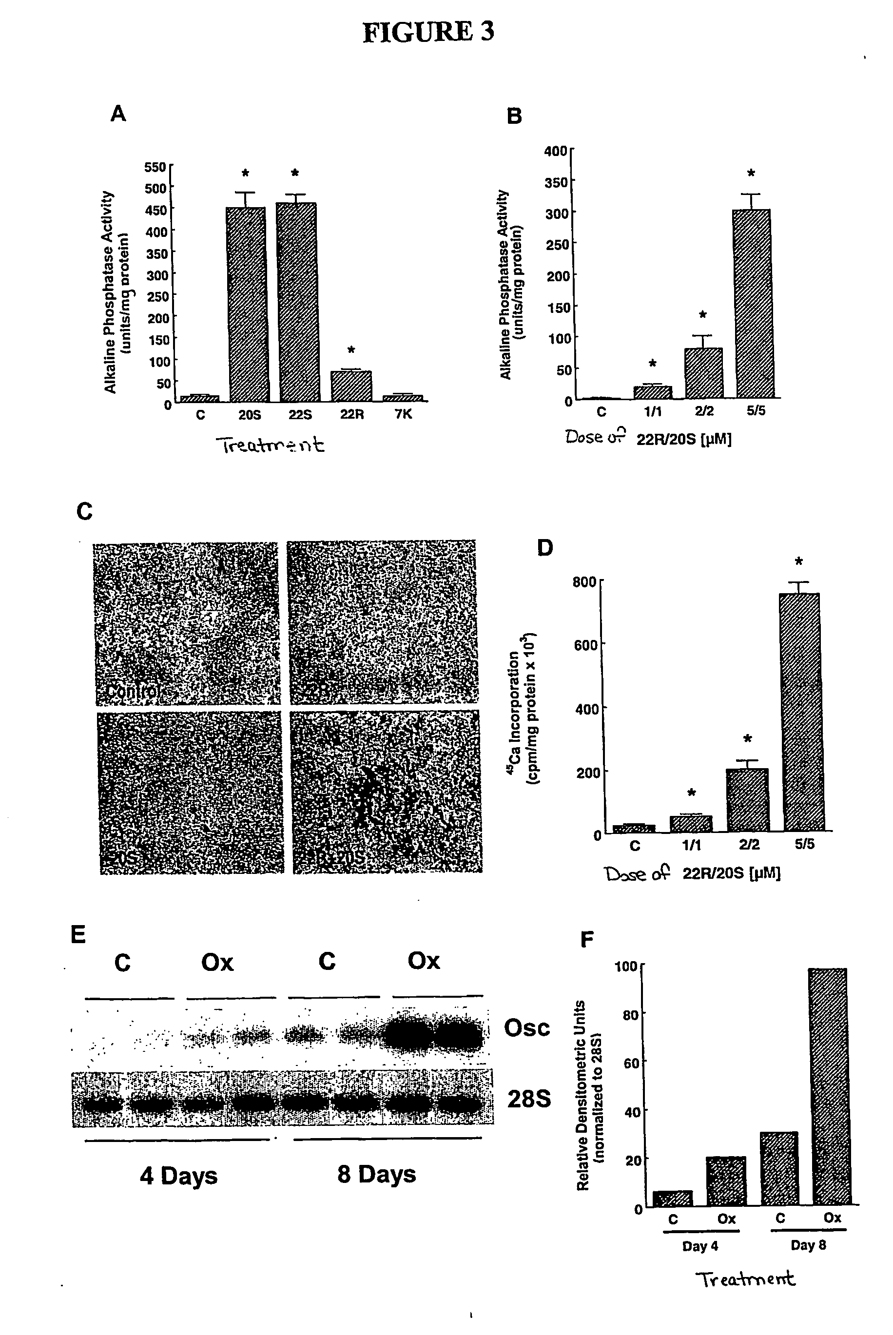 Agents and methods for enhancing bone formation by oxysterols in combination with bone morphogenic proteins