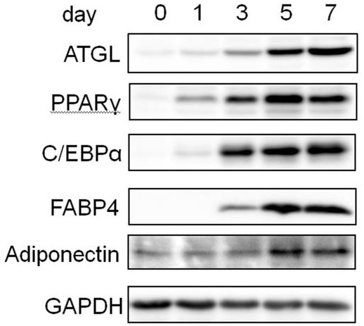 Medical application of miR-574-5p to diabetes and related diseases thereof