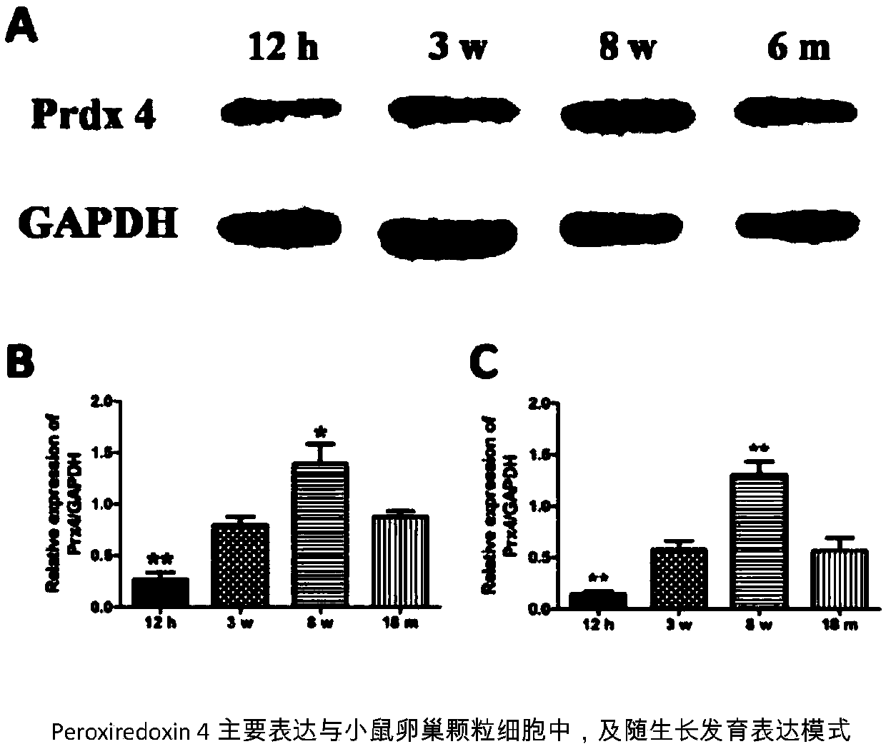 Application of enhancing antioxidation of oocyte cultured in vitro by Peroxiredoxin 4 protein