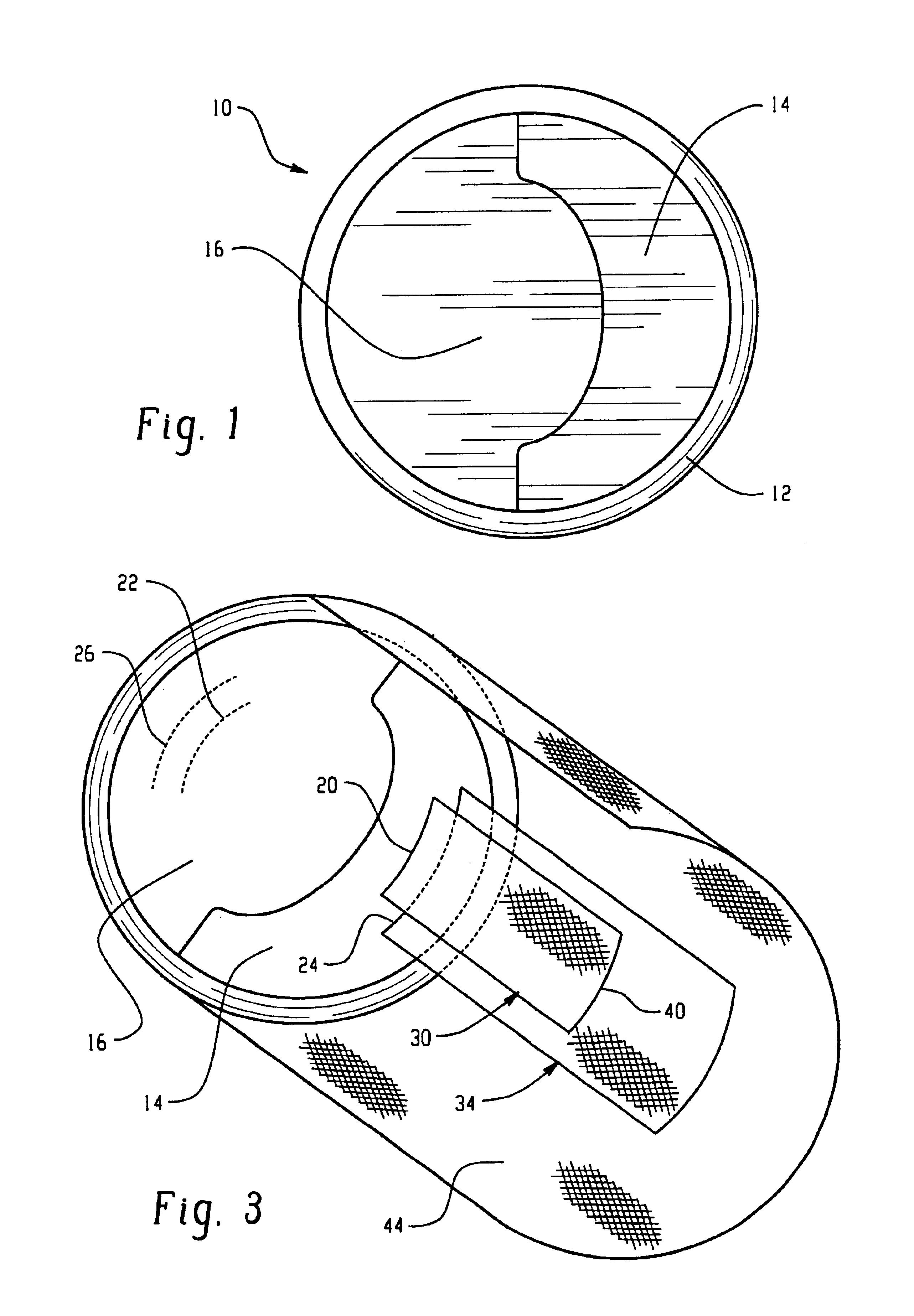 Replacement mitral valve
