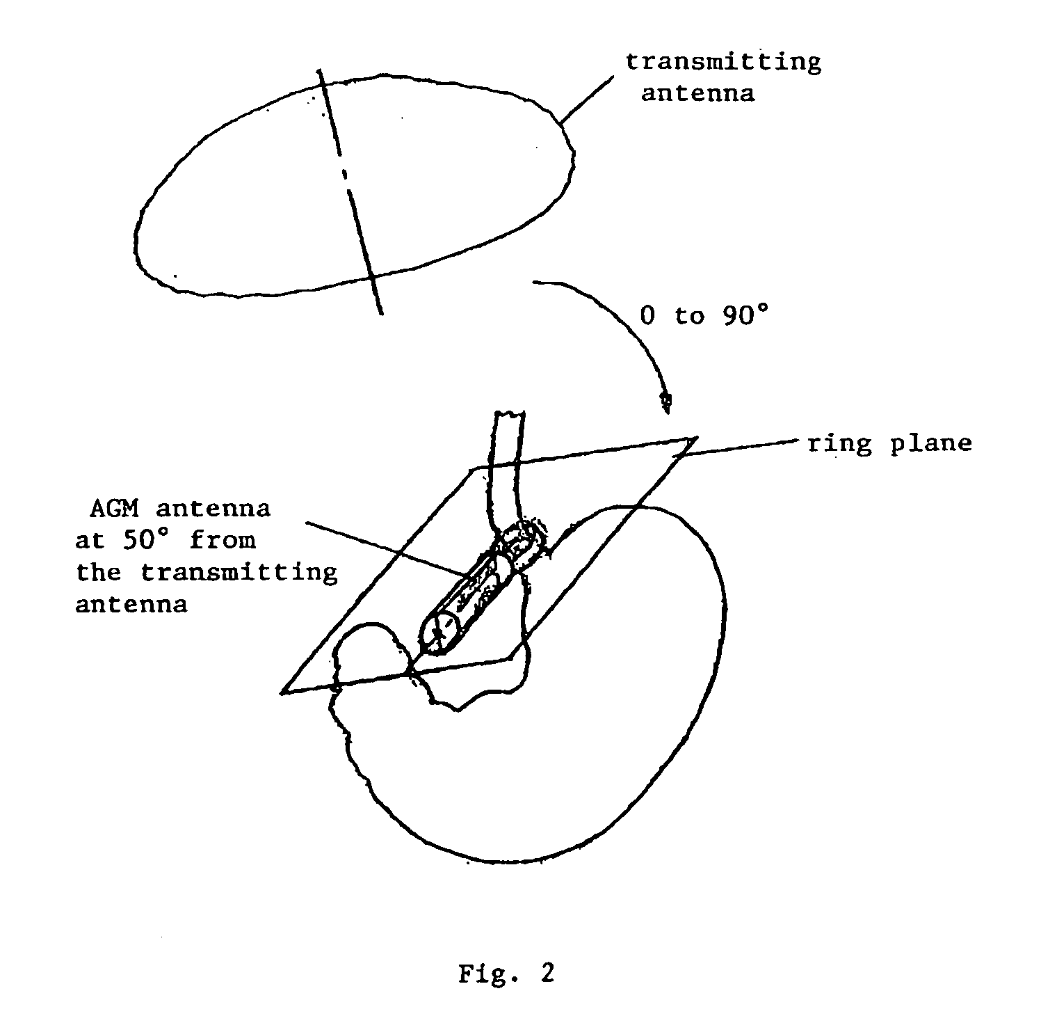 Motor-Operated Gastric Banding Device Or Gastric Ring Comprising At Least One Misaligned Receiving Antenna For Power Supply, Remote Control And Data Transmission By Means Of Induction