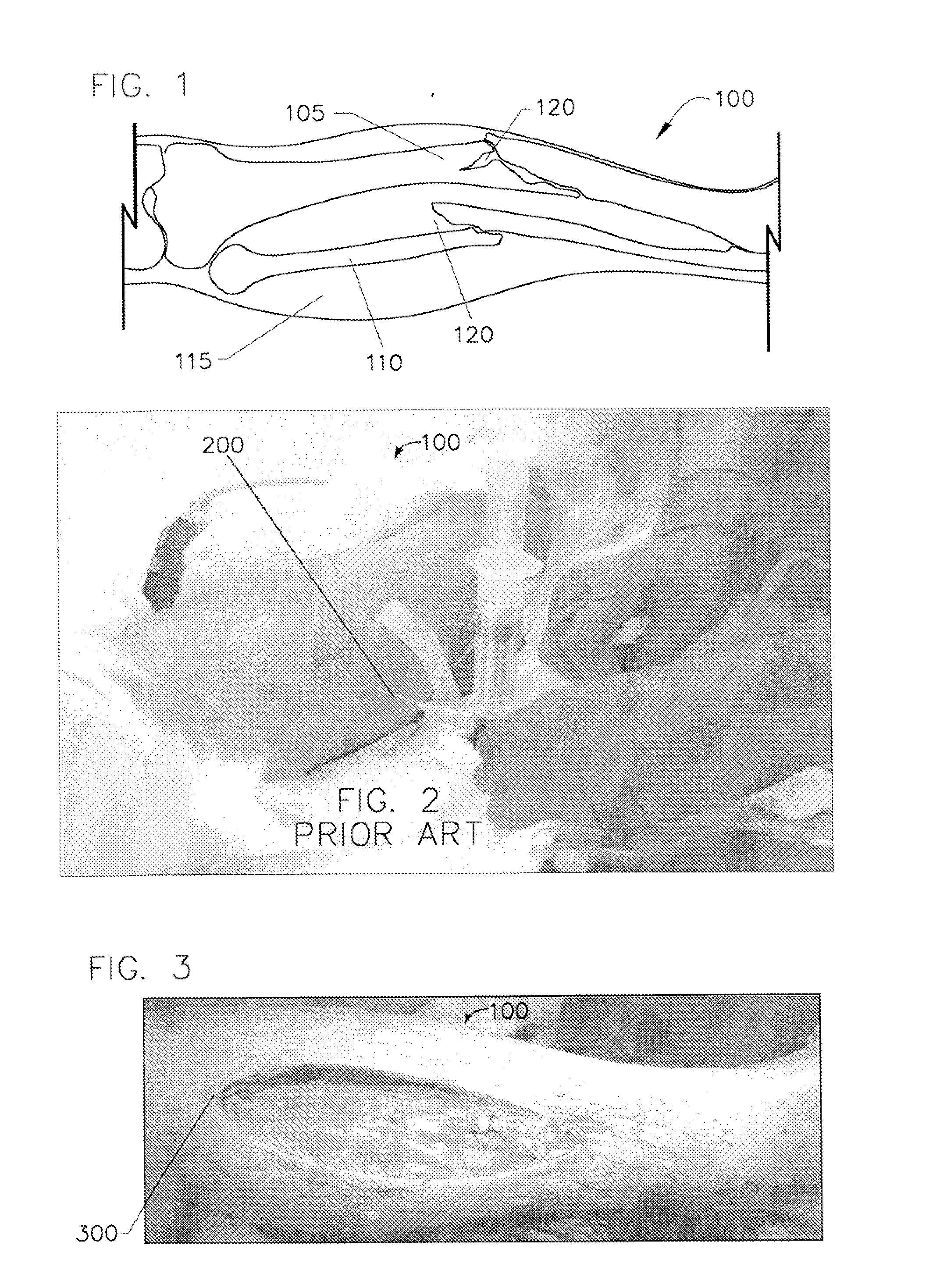 Method and system for monitoring oxygenation levels of compartments and tissue