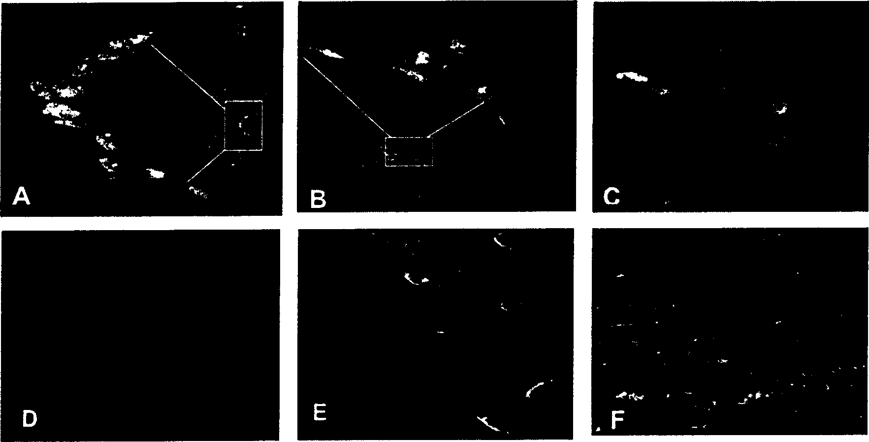 Method for inducing fibroblast to form cartilage cells