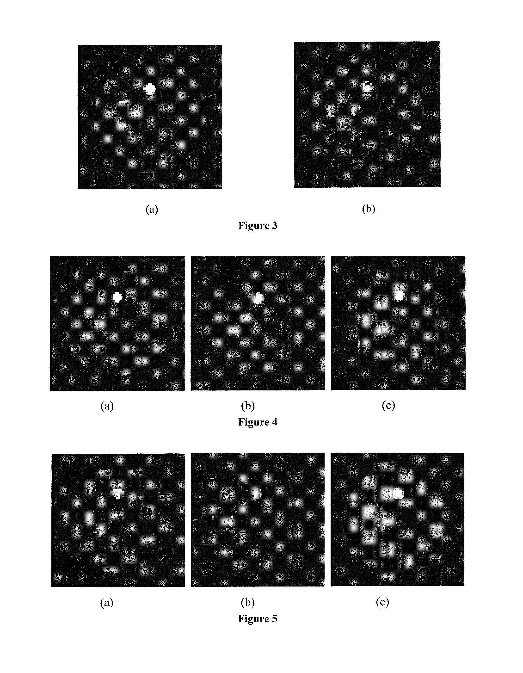 PRCA-based method and system for dynamically re-establishing PET image
