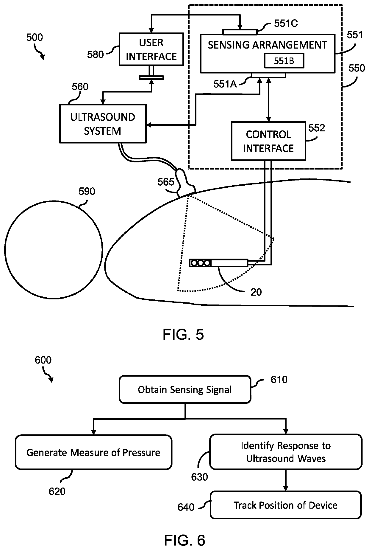 Tracking an interventional device during an ultrasound imaging procedure