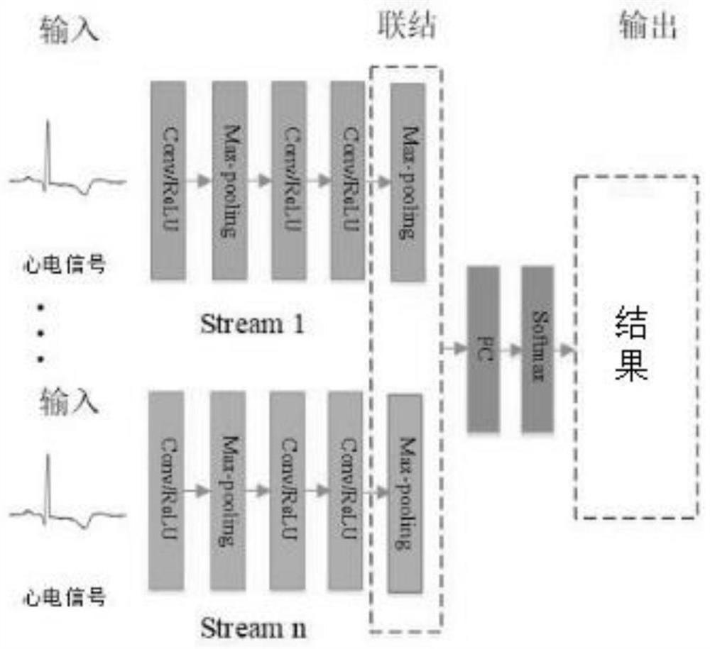 Wearable individual electrocardiogram detection method