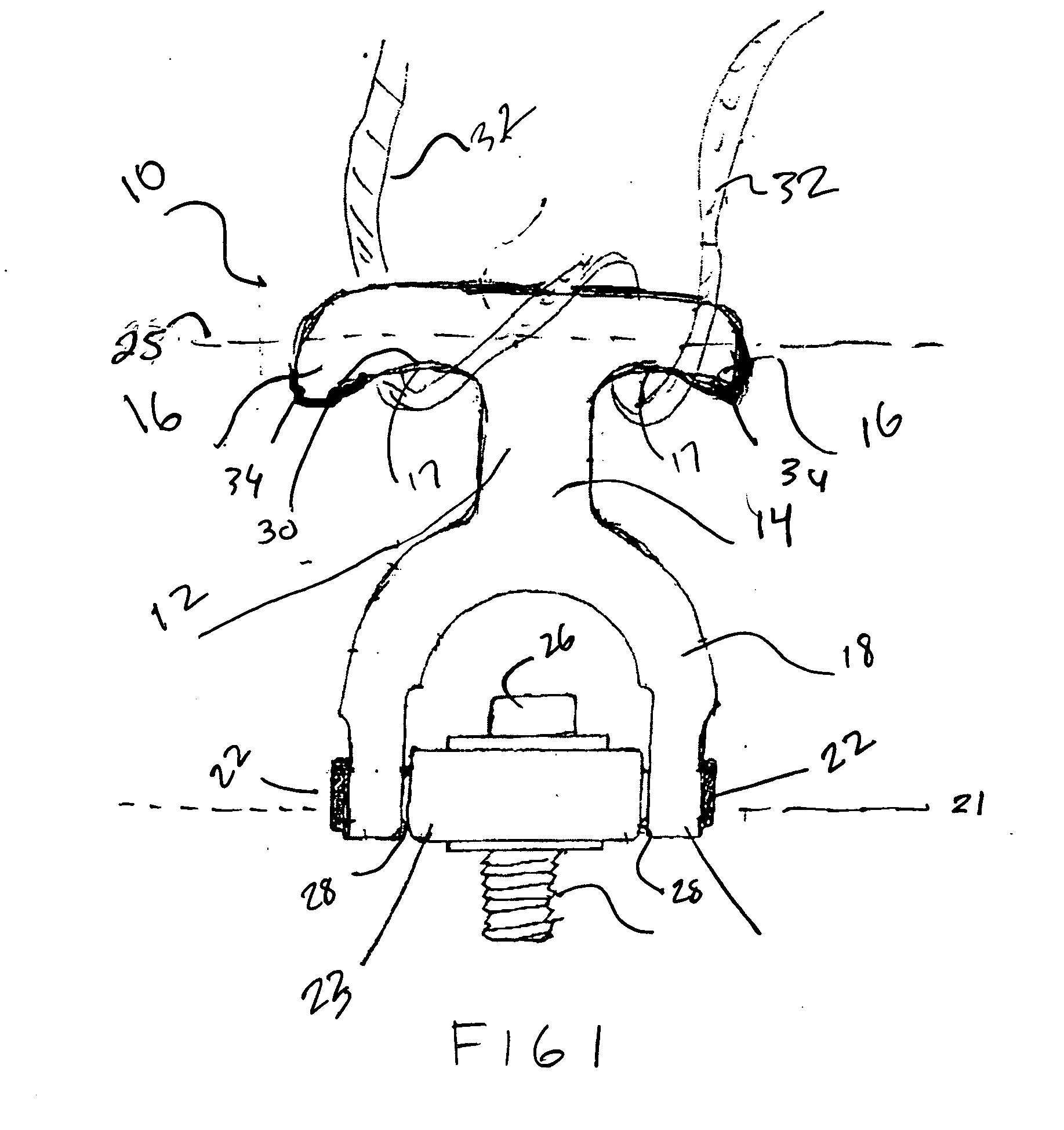 Hoist ring