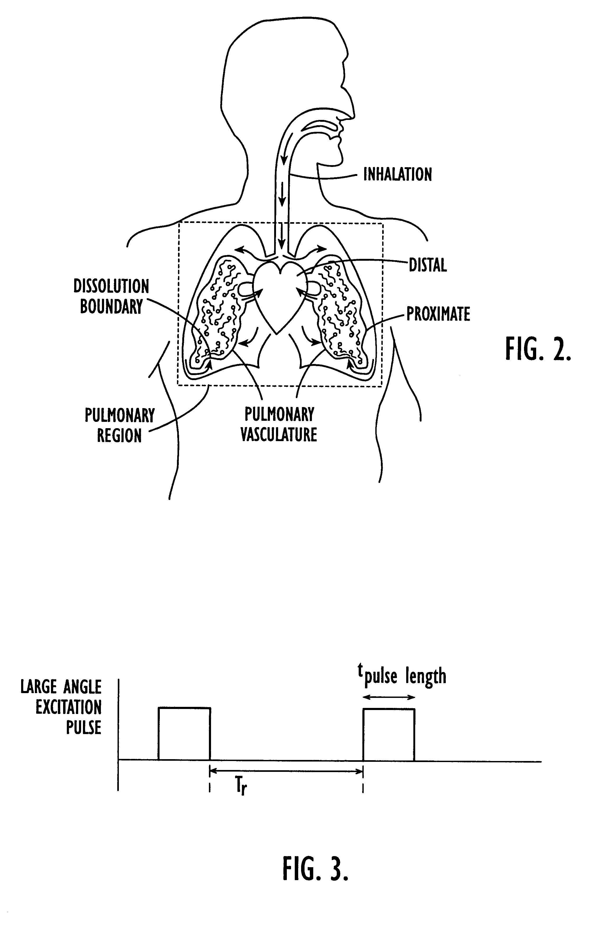 Methods for imaging pulmonary and cardiac vasculature and evaluating blood flow using dissolved polarized 129Xe