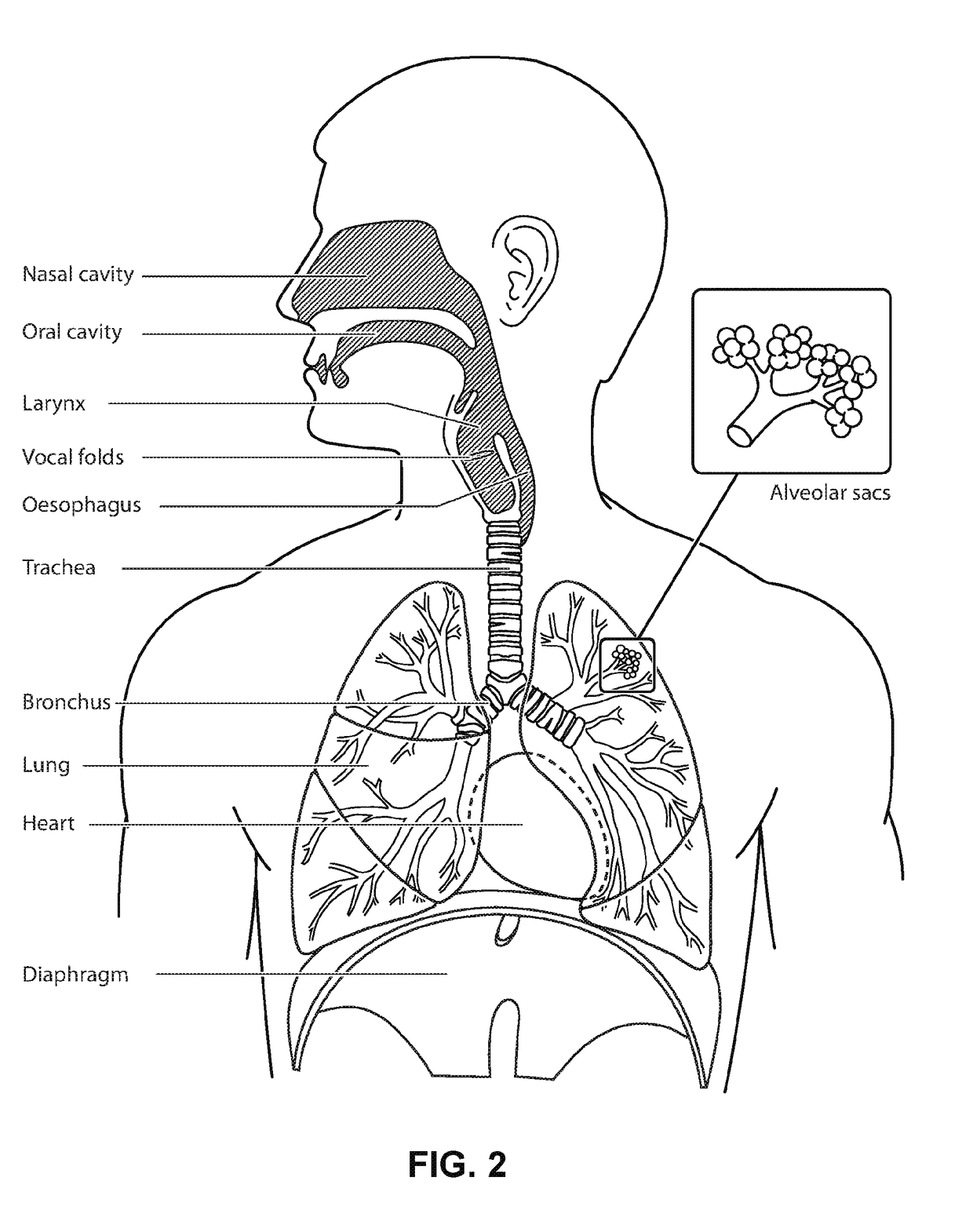 Gas flow regulating apparatus for respiratory treatment