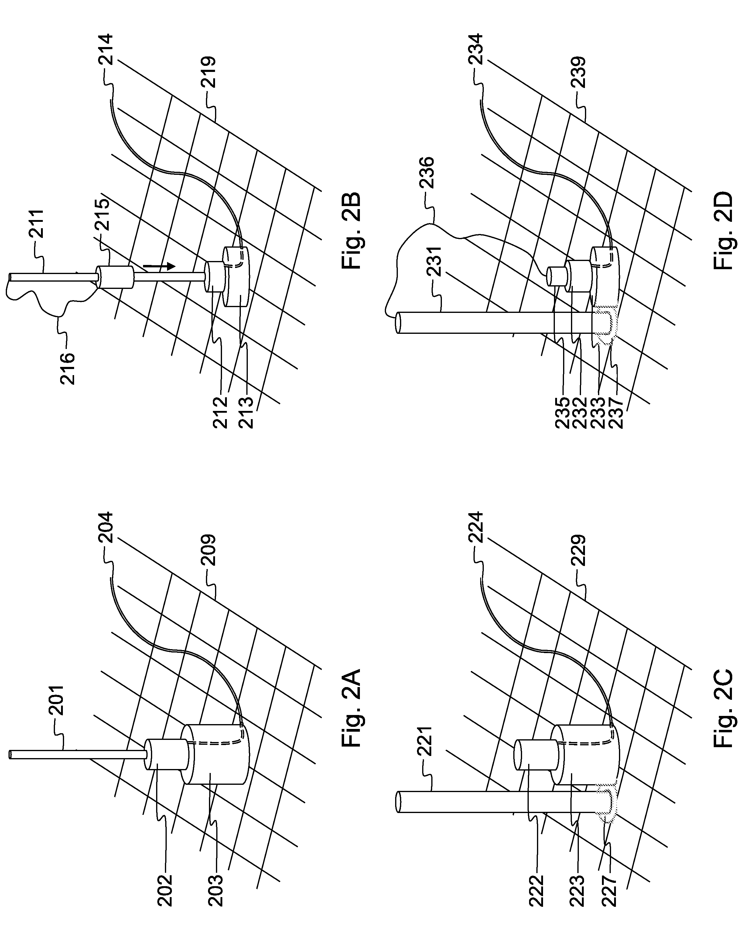 Device and method for radio frequency ablation (RFA)