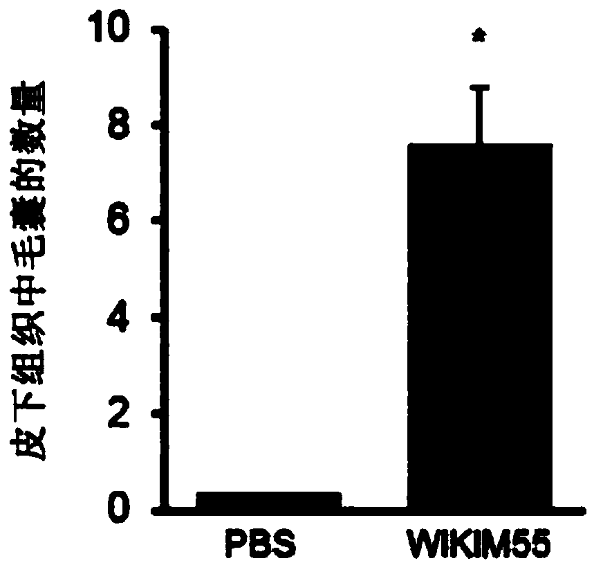 Lactobacillus curvatus wikim55 having activity of promoting hair growth, and composition containing same.