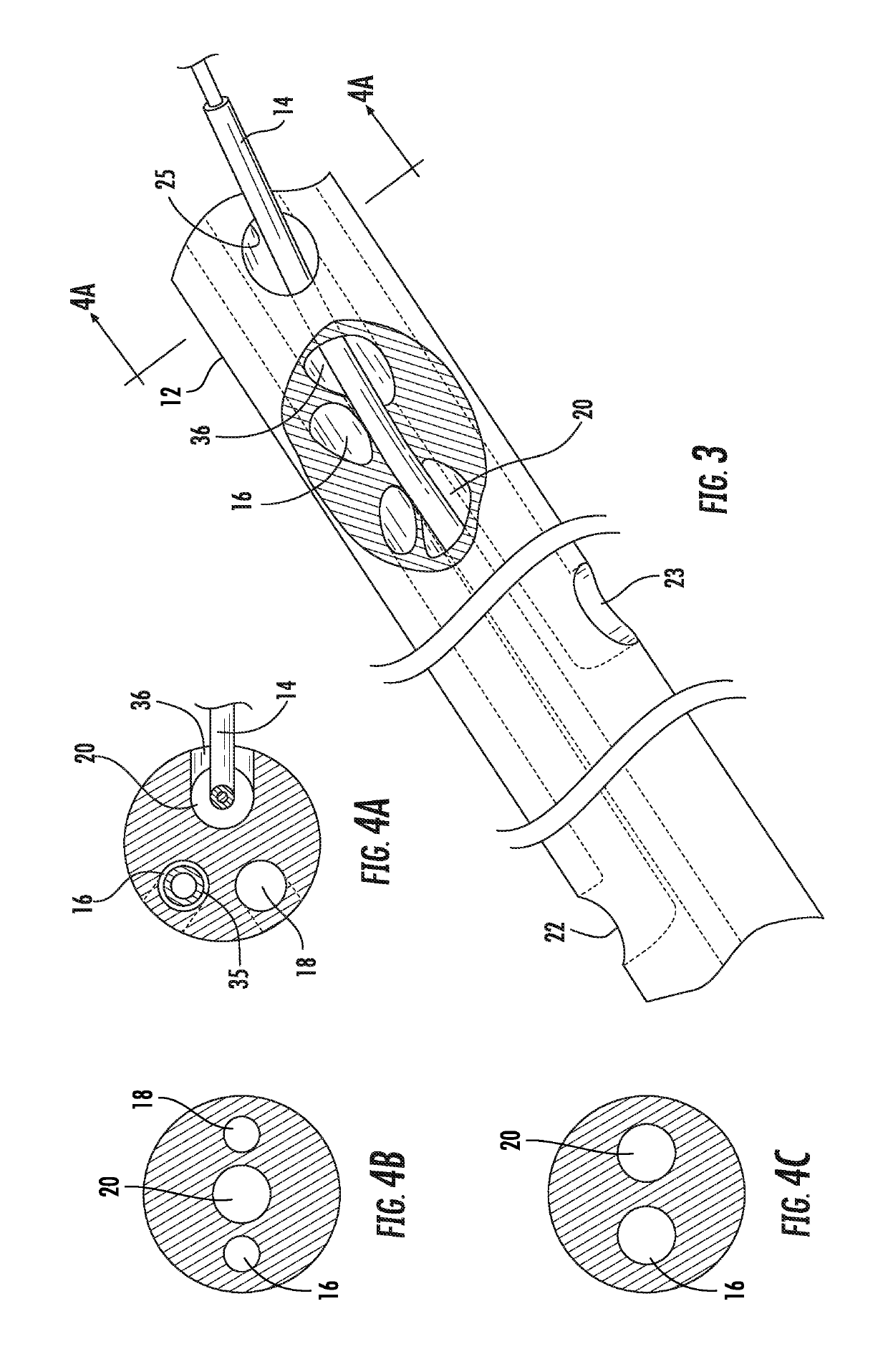 Rapid insertion integrated catheter and method of using an integrated catheter